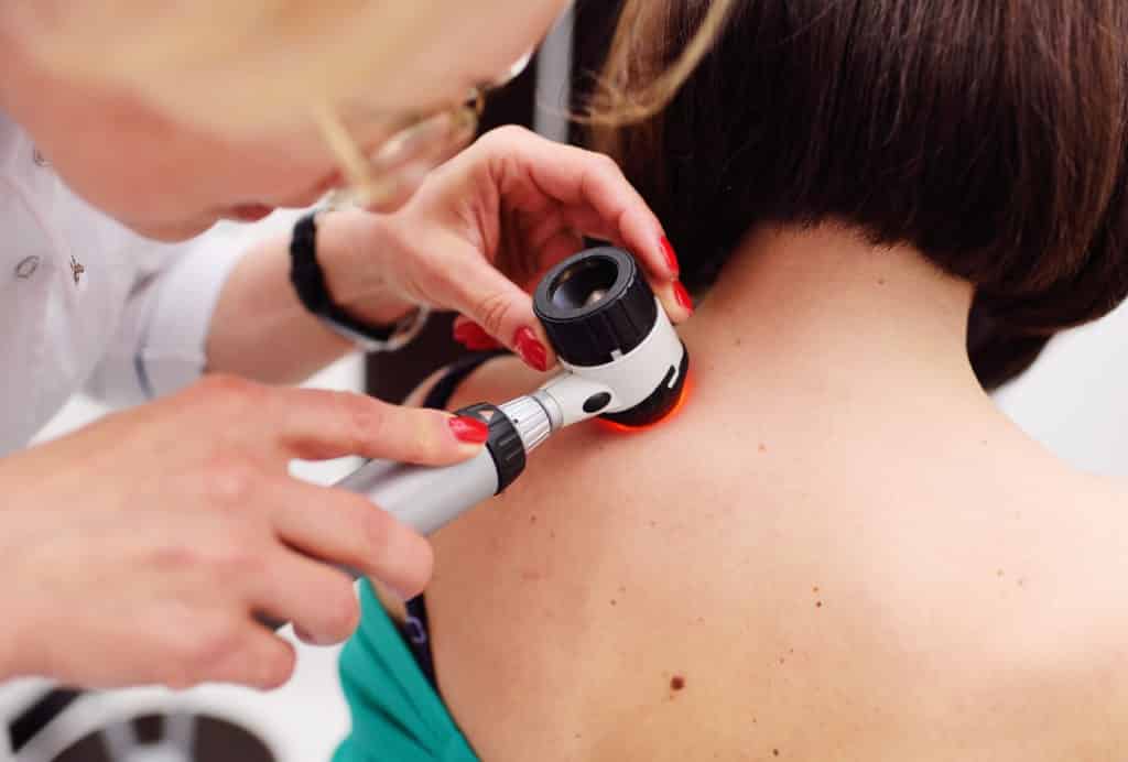 melanoma diagnoinspectionsis. the doctor examines the patient's mole